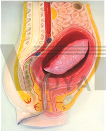 The model of abruptio placentae (1part)